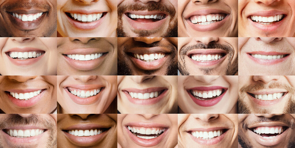 grid of smiling mouths